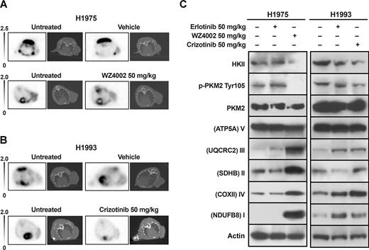 Figure 6. 18F-FDG PET/CT imaging studies and levels of HKII, p-PKM2 Tyr 105, total PKM2, and OXPHOS in tumor xenografts. Nude mice bearing H1975 or H1993 tumors were treated for 3 days by oral gavage with 50 mg/kg of erlotinib, WZ4002, crizotinib or vehicle. A and B, imaging studies with 18F-FDG PET/CT were performed before (left) and after treatment with efficient inhibitor or vehicle (right) of H1975 (A) and H1993 (B) tumors. Representative transaxial 18F-FDG PET and coregistered CT images are shown. C, surgically removed tumors (3 for each cell line and for each treatment) were homogenized and assayed for levels of HKII, p-PKM2 Tyr105, total PKM2, and OXPHOS by Western blot analysis. Actin served to ensure equal loading.