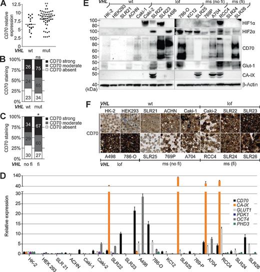 Figure 2. Association of CD70 with the VHL mutation status. A, CD70 gene expression in ccRCC tissue with mutated or wt VHL. **, P < 0.001 by t test. B, histogram representing CD70 expression intensities in ccRCCs with mutated or wt VHL. ns, not significant by Pearson χ2 test. C, CD70 expression intensities assigned to ccRCC tissue with function of pVHL predicted to be impaired or not impaired. In silico analysis was done with SDM. *, P < 0.05 by Pearson χ2 test. D, mRNA levels of CD70, the HIF1α-dependent genes CA-IX and PDK1, the HIF2α-dependent genes GLUT1, OCT4, and PHD3; (E) Western blot analysis of HIF1α, HIF2α, CD70, CA-IX, and Glut1; and (F) cell microarray stained for CD70 in different RCC cell lines (×20 magnification; bar, 20 μm). The VHL mutation status is indicated as wt, loss of function (lof), missense (ms) with (fi) and without (no fi) functional impact on pVHL.
