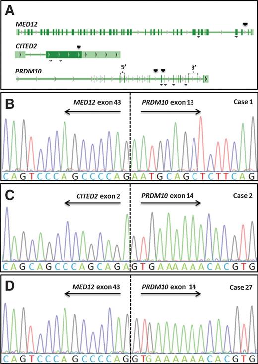 Figure 1. A, illustration of the MED12, CITED2, and PRDM10 genes with vertical arrow heads indicating the breakpoint locations, horizontal arrows indicating the locations of PCR primers, and braces indicating the locations of probes for quantitative real-time PCR. The coding parts of the genes are indicated in dark green color. B to D, partial chromatograms of amplified fragments corresponding to in-frame MED12/PRDM10 and CITED2/PRDM10 fusion transcripts.