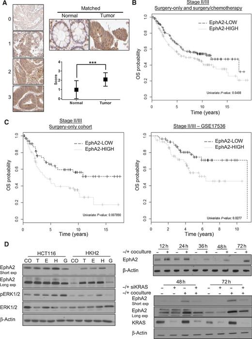 Figure 4. EphA2 is a strong negative prognostic factor in early-stage colorectal cancer. A, left, IHC scoring of EphA2 in colorectal cancer tissues. Right, EphA2 expression in matched normal colon tissue and carcinoma, as determined by IHC. B, survival curve using the Kaplan–Meier estimation comparing EphA2 levels in the entire stage II/III colorectal cancer group. C, left, survival curve using the Kaplan–Meier estimation comparing EphA2 levels in the stage II/III surgery-only group. Right, survival curves using the Kaplan–Meier estimation comparing EphA2 levels in stage II/III validation group (GSE17536). Univariate (Cox proportional hazards regression) P value was reported. D, left, HCT116 and HKH-2 cells were incubated with 25 ng/mL TGFα (T), EGF (E), HGF (H), or GAS6 (G) for 24 hours, and EphA2, pERK1/2, and ERK1/2 expression determined by WB. Right upper, HKH-2 cells were cocultured with CCD-18Co cells for the indicated time and EphA2 expression levels determined by WB. Right lower, HKH-2 cells were transfected with 10 nmol/L SC or KRAS siRNA for 12 hours and thereafter cocultured with CCD-18Co cells for the indicated time and EphA2 expression levels determined by WB.
