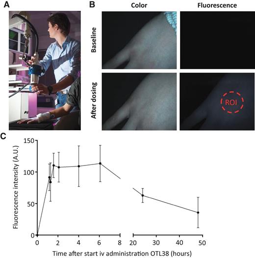 Figure 1. Fluorescence measurements in the skin of healthy volunteers. A, a researcher measuring skin fluorescence using the Artemis imaging system. B, color (left column) and fluorescence (right column) images of a healthy volunteer at baseline (top row) and after receiving a dose of OTL38 (bottom). Note that a bright fluorescent signal is detected after dosing, and fluorescence intensity can be measured within a region of interest (ROI; dashed circle). C, fluorescence intensity (measured in arbitrary units) in an ROI over time (in hours). The fluorescence signal reached peak levels at approximately 2 hours and was stable for up to 6 hours, then decreased over the following 48 hours.