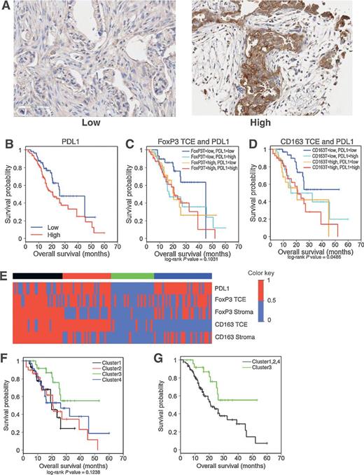 Immunologic and Metabolic Features of Pancreatic Ductal Adenocarcinoma