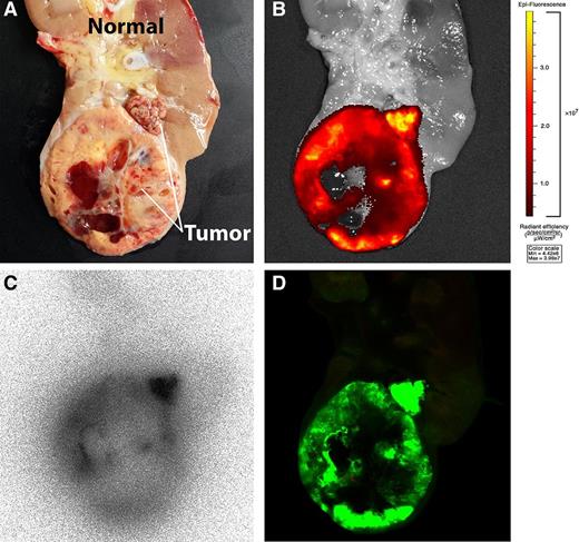 Figure 2. High accumulation of dual-labeled girentuximab in tumor tissue can be visualized with both fluorescence and radionuclide imaging. A, macroscopy. B, fluorescence image acquired with the IVIS Lumina fluorescence imager. C, autoradiography. D, Odyssey fluorescence flatbed scanner image.