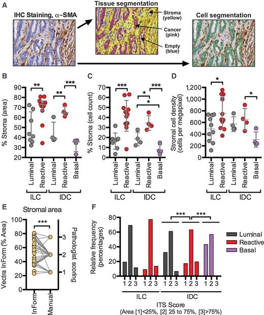 Figure 2. Reactive breast cancers had the highest stromal content independently of ILC/IDC classification. A, α-SMA IHC staining with tissue and cell segmentation maps for an example case, A1H3. Tissues were segmented into cancer (red), stroma (yellow), empty (blue) using InForm 2.0 (Vectra). Images were selected to include those representing the core invasive tumor, excluding images with edge artifacts and structures unrelated to the tumor including normal ducts and ductal carcinoma in situ (DCIS). Percent stroma determined by area (B) and by cell counting (C). D, stromal cell density was calculated from the absolute stromal area and cell counts within the compartment. ILC cases were selected from all available sections with clinical data and matching RPPA classification (n = 21). ILC includes ILC and ILC mixed cases. Representative IDC cases for RPPA subtypes for B–D. (n = 4 ea; Luminal, Reactive, and Basal) were selected from available cases on the basis of silhouette analysis. E, paired correlation of InForm stromal area from (B) and manual pathologist scoring of stromal area. F, stromal content of cancers separated by histopathology and RPPA subtype as determined by manual scoring (n = 70 for ILC, n = 331 for IDC). Symbols and error bars represent the average ± 1SD. Statistical analyses (paired Student t test, unpaired Student t test, paired Spearman correlation, or ANOVA as appropriate) were performed within histopathology groups. *, P ≤ 0.05; **, P ≤ 0.01; ***, P ≤ 0.001.