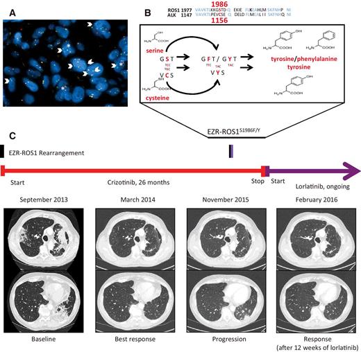 Crizotinib-Resistant ROS1 Mutations Reveal a Predictive Kinase ...