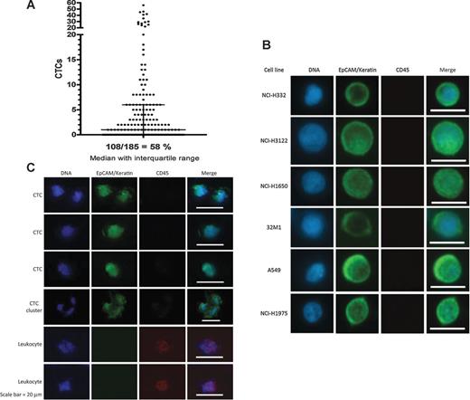 Figure 2. A, CTC counts of all patients from all visits. Overall, 185 wire samples were taken from a total of 50 patients, resulting in CTC detection in 108 samples, as determined by immunofluorescence analysis. B, representative images of 6 different lung cancer cell lines (NCI-H332, NCI-H3122, NCI H1650, 32M1, A549, and NCI-H1975) isolated by the CellCollector in spiking experiments (in vitro). Tumor cells were identified as EpCAM- and/or pan-keratin-positive events (green). C, representative images of CTCs and CTC clusters isolated with the wire and 2 leukocytes. Tumor cells were identified as EpCAM- and/or pan-keratin-positive (green) and CD45-negative (red) events. Hoechst33342 (blue) was used for nuclear counterstain. Scale bars, 20 μm.