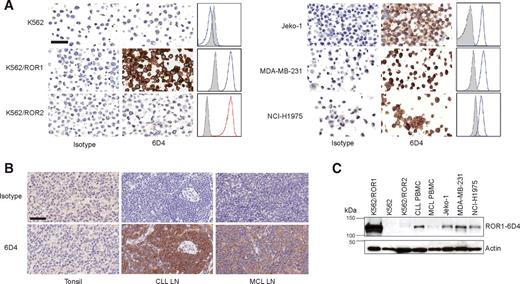 Analysis of ROR1 Protein Expression in Human Cancer and Normal Tissues ...