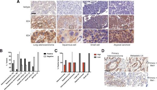 Figure 4. Membrane ROR1 staining in lung cancer using the 6D4 mAb. A, Representative IHC images of ROR1 expression in subtypes of lung cancer samples stained with the 6D4 mAb. Scale bar represents 100 μm. Regions in squares in middle are magnified 10× in bottom panels. B, Percentage of ROR1+ tumors in different subtypes of lung cancer. C, Percentage of ROR1high and ROR1low tumors in the ROR1+ lung cancer subset. D, Representative IHC images of ROR1 expression in primary and matched metastatic lymph nodes of ROR1+ lung adenocarcinomas. Scale bar represents 50 μm.