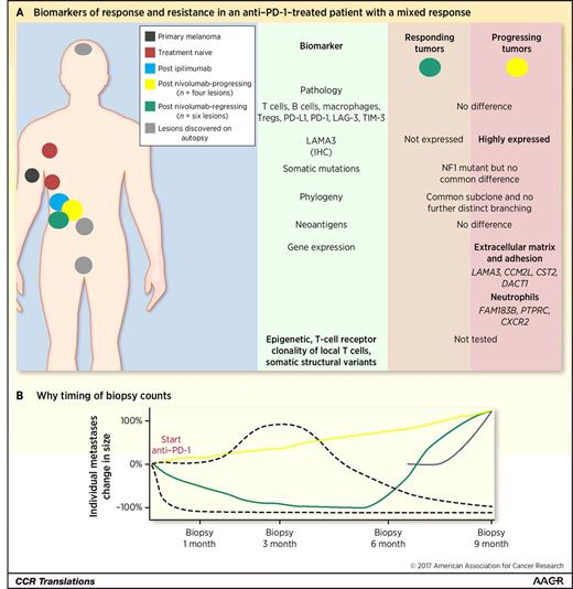 Figure 1. Can we pick the anti–PD-1–responding lesions from the progressing lesions? Not yet. A, Ascierto and colleagues analyzed multiple metastases from an individual patient with mixed clinical responses to nivolumab (1). The authors utilized whole-exome sequencing, RNA expression profiling, and quantitative pathology of immune cell infiltrates to evaluate potential mechanisms of response and resistance in six responding and four progressing tumors, all at the same time point on therapy. B, The timing of biopsies is critical when correlating biomarkers with response, as the kinetic of response can vary, tumors that initially respond but subsequently develop resistance (green), new tumors can arise on treatment (gray), and tumors can progress throughout treatment (yellow). The timing of the biopsies throughout the course of a patient treatment will have dramatic effects on the composition of those tumors in that point in time and must be considered when analyzing on-treatment patient biopsies. Tregs, regulatory T cells.