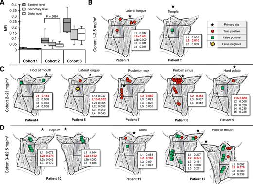 Figure 4. Distribution of lymph nodes by level. A, Quantitative analysis from closed-field imaging of lymph nodes contained within the sentinel level, secondary level, and distal level for the 2.5 mg/m2 (cohort 1), 25 mg/m2 (cohort 2), and 62.5 mg/m2 (cohort 3) dose groups. Illustrations of lymph node distribution per level with location of primary tumor for cohort 1 (B), cohort 2 (C), and cohort 3 (D). Inset values represent MFI for each level (“L”) with red font indicating sentinel drain echelon for respective primary tumor location. Patient 3 and 6 contained true negatives only, not shown.