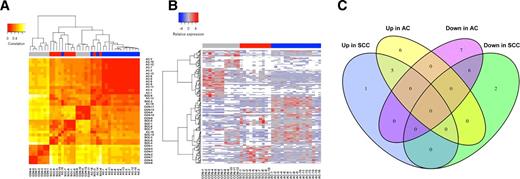 Figure 1. Identification of adenocarcinoma (AC)- and SCC-specific miRNAs by statistical analysis of miRNA-seq data. A, Heatmap of pairwise correlation values of 38 samples in testing set (Table 1). The Pearson correlation coefficients were calculated for log2 transformed ratios of the miRNAs panels with more than 1,000 RPM in healthy individuals and in adenocarcinoma and SCC patients. B, Hierarchical clustering of normalized miRNA expression levels for the 27 miRNAs that have the strongest statistical significance for differential expression between adenocarcinoma and SCC samples. Average linkage and 1-Pearson correlation as a distance metric were used for the clustering. C, The Venn diagram is used to identify overlapping and nonoverlapping miRNAs in the analysis of adenocarcinoma and SCC upregulated or downregulated miRNAs after comparison with healthy subjects in the testing group. The miRNAs with a 2-fold change difference (up or down) were included.