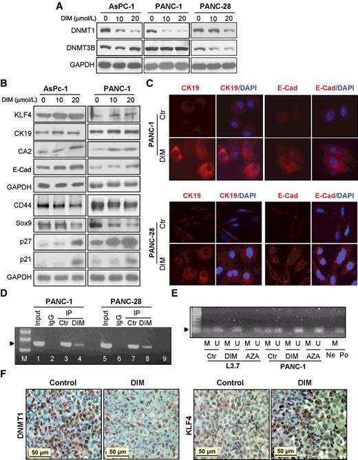 Figure 5. Effects of DIM on DNMT1, KLF4, and cell differentiation marker expressions in pancreatic cancer cells. A, Western blot analysis of DNMT1 and DNM3B protein expression at 48 hours after different doses of DIM treatment in pancreatic cancer cells. GAPDH expression served as the loading control. B, Western blot analysis of KLF4 and related marker expressions at 48 hours after different doses of DIM treatment. C, IF staining of CK-19 and E-Cadherin expressions at 48 hours after DIM treatment. D, ChIP analysis of DNMT1 binding to the promoter region of KLF4 in pancreatic cancer cells treated with control (DMSO) or DIM (20 μmol/L) for 2 days. E, Methylation-specific PCR analysis of DNA derived from pancreatic cancer cells treated with DMSO control, 15 μmol/L DIM, or 2.0 μmol/L AZA for 5 days. Note: H20 (Ne) and methylation-positive DNA sample (Po) were added, respectively, into PCR reactions containing methylation-specific primers. F, IHC analysis of DNMT1 and KLF4 expression in xenograft tumor tissue samples of PANC-1 cells derived from mice fed with DIM or control food, respectively (See also Supplementary Fig. S7).