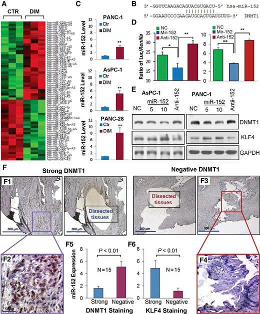Figure 6. Regulation of miR-152 and its downstream gene expressions by DIM in pancreatic cancer cells. A, Microarray analysis identification of differentially expressed miRNAs (heatmap) in PANC-1 cells treated with DIM (15 μmol/L) or control (DMSO) for 48 hours. B, miRNA target prediction indicates that miR-152 seed sequence can bind to 3′-UTR region of DNMT1 mRNA. C, RT-qPCR validation of miR-152 expression in the RNA samples used for microarray analysis (top) or newly extracted RNA samples from cells treated with DIM (15 μmol/L) or control (DMSO) for 48 hours (bottom two). D, Effect of cotransfection of pMIR-DNMT1-3′UTR reporter with nontargeting control (NC), miR-152 mimic or inhibitor oligos on luciferase activity in AsPC-1 (left) and PANC-1 (right) cells. E, Western blot analysis of DNMT1 and KLF4 expressions at 48 hours after transfection of NC, miR-152 mimic or inhibitor oligos in AsPC-1 and PANC-1 cells. F, Representative images of human pancreatic cancer tissues with strong (F1 and F2: higher magnification) or negative (F3 and F4: higher magnification) DNMT1 staining were microdissected and used for RT-qPCR analysis of miR-152 expression with quantitative results showing in F5. Similarly, microdissection samples with strong or negative KLF4 staining were used for RT-qPCR analysis of miR-152 expression, with quantitative results showing in F6; *, P < 0.05; **, P < 0.01 versus control (See also Supplementary Fig. S8).