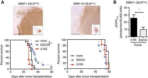 Figure 6. Glutamine inhibition retards tumor growth in vivo in an orthotopic murine model. A, Immunohistochemistry of mouse brain injected with control cells using a human–MHC class I antibody (top) and survival curves of mice after orthotopic injection of GLNHigh (GBM-1, n = 10, left) and GLNLow (GBM-10, n = 5, right) cultures in vivo (bottom). Cells were treated with EGCG (110 μmol/L) for 6 days or 2-DG (5 mmol/L) for 48 hours prior to injection in mouse brain (i.c.). Statistical analyses were performed with the log-rank test compared with control (**, P < 0.01). B, Mitochondrial respiration sustained with glutamine (ΔOCRGLN) was recorded after injection of glutamine in isolated tumor cells from GBM1-tumor bearing mice. On the day of sacrifice, tumors from mice injected with control or EGCG-pretreated cells were isolated, enriched and ΔOCRGLN was recorded using the Seahorse technology (n = 2 in triplicate; t test, * P < 0.05).