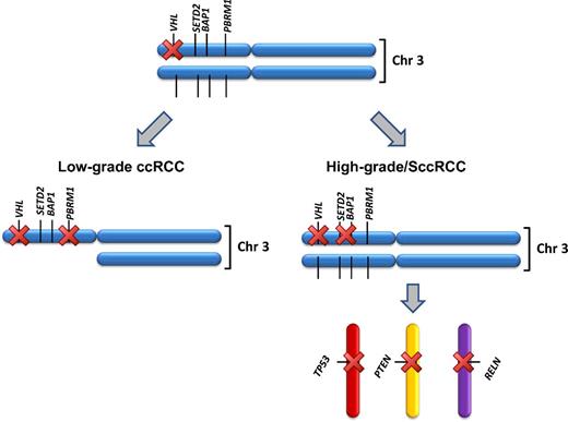 Figure 5. High-grade SccRCC and low-grade ccRCC show a distinct molecular pathogenesis. Schematic illustration of the proposed sequence of events in low-grade ccRCC versus high-grade SccRCC.