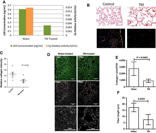 Figure 5. Tetrathiomolybdate (TM) decreases human LOX levels and collagen deposition in premetastatic lungs in vivo. A, LOX was reduced in the TM-treated lungs (P = .03). Human LOX ELISA of one representative water (N = 6) and tetrathiomolybdate (N = 6) premetastatic lungs at 4 weeks after tumor implantation and 2 weeks post-tetrathiomolybdate administration. B, Picrosirius Red staining of premetastatic lungs measuring parallel (top) and orthogonal (bottom) polarized light intensity of fibrillar collagen. C, Average quantification of Picrosirius using ImageJ, including representative figures quantified within the boxed area (water, n = 10; tetrathiomolybdate n = 5; D and E). Accordingly, SHG imaging analysis confirmed that less collagen was deposited in lungs with tetrathiomolybdate treatment (P = 0.04) and that the collagen fibers formed with tetrathiomolybdate therapy were shorter relative to those formed in control animals P = 0.04; F.