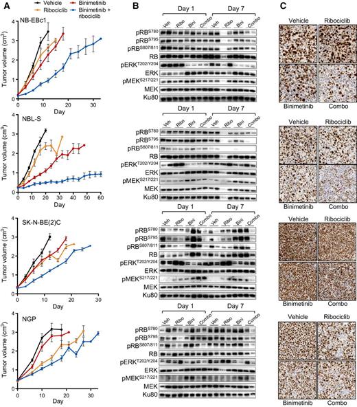 Figure 5. Neuroblastoma xenografts are sensitive to combined binimetinib and ribociclib treatment. Xenografts were treated with vehicle, single-agent binimetinib (3 mg/kg twice a day), single-agent ribociclib (75 mg/kg every day), or the combination. A, Tumor growth delay, B, MAPK and RB signaling immunoblots, and (C) Ki67 immunohistochemical staining are shown for each model tested. Linear mixed-model statistics were performed as described in the methods. Comparing the combination treatments to the closest single-agent study groups: NB-EBc1 (P = 0.0003), NBL-S (P < 0.0001), SK-N-BE(2)C (P = 0.0129), and NGP (P = 0.1214).