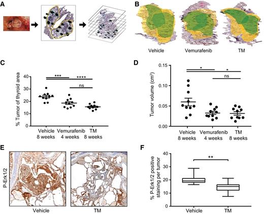 Figure 3. TM treatments reduce tumor load and volume in TBP mice. A, Diagram of tumor load and volume analysis. Left: Thyroids (dotted line) were removed from TBP mice euthanized 8 weeks after being treated with vehicle, vemurafenib, or TM. Middle: Thyroids were fixed enblock, paraffin mounted, sections taken every 200 microns, and H&E stained. Right: Tumor area (dark green regions) in the thyroid (yellow outline) was determined by a pathologist blinded to the mouse genotype to calculate the tumor load (% of the ratio of tumor area/thyroid area of all sections) and tumor volume (cm3). B, A representative three-dimensional reconstruction of a thyroid enblock from a TBP mouse euthanized 8 weeks after being treated with vehicle, vemurafenib, or TM. Yellow outlines the thyroid area whereas green outlines the tumor boundaries. Both lobes of the thyroid are shown. C, % tumor load (% of thyroid occupied by tumor, each sample is a filled circle, mean ± SEM shown as bars) at the 8-week fixed endpoint in three cohorts of 10 TBP mice orally treated with vehicle, vemurafenib, or TM. D, Tumor volume (cm3, each sample is a filled circle, mean ± SEM shown as bars) at the 8-week fixed endpoint in three cohorts of 10 TBP mice orally treated with vehicle, vemurafenib, or TM. E, Representative image of a thyroid section hematoxylin stained (purple) and immunohistochemically stained with an anti-P-Erk1/2 antibody (brown) isolated from a TBP mouse euthanized at the 8-week fixed endpoint after being treated with vehicle (left) or TM (right). F, Boxplot of % P-Erk1/2 positive area per tumor (18 tumors from 10 mice in each cohort) at the 8-week fixed endpoint in TBP mice treated with either vehicle or TM. *, P < 0.05; **, P < 0.01; ***, P < 0.005; ****, P < 0.001; ns, not significant.