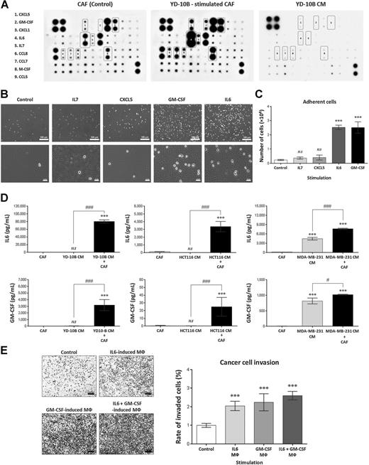 Figure 3. GM-CSF and IL6 are the factors secreted by cancer cell–stimulated CAFs that induce monocyte differentiation. A, Human cytokine array for CAF culture supernatant, CAF culture supernatant after YD-10B cancer CM stimulation, and YD-10B CM. Cytokines upregulated in cancer-stimulated CAFs are indicated with red boxes. B, Representative photographs of THP-1 monocyte differentiation into macrophages after treatment with 12.5 ng/mL IL7, CXCL5, GM-CSF, or IL6 for 72 hours (scale bar, 100 μm for low-magnification pictures and 10 μm for high-magnification pictures). C, Quantification of THP-1 monocyte differentiation into macrophages after cytokine treatment. n = 3; error, SE. D, GM-CSF and IL6 secretion by CAFs after treatment with CM from different cancer cell types. CAFs were treated with CM from YD-10B OSCC cells, HCT116 colon carcinoma cells, or MDAMB231 breast carcinoma cells for 24 hours. GM-CSF or IL6 secretion was measured by ELISA. n = 3; error, SD. E, Invasion assay for YD-10B cells alone (control) or YD-10B cells cocultured with macrophages derived from THP-1 monocytes by treatment with 12.5 ng/mL IL6, 12.5 ng/mL GM-CSF, or 12.5 ng/mL IL6 + 12.5 ng/mL GM-CSF (scale bar, 100 μm). n = 3; error, SD. ns, not significant; ***, P < 0.001; #, P < 0.05; ###, P < 0.001.
