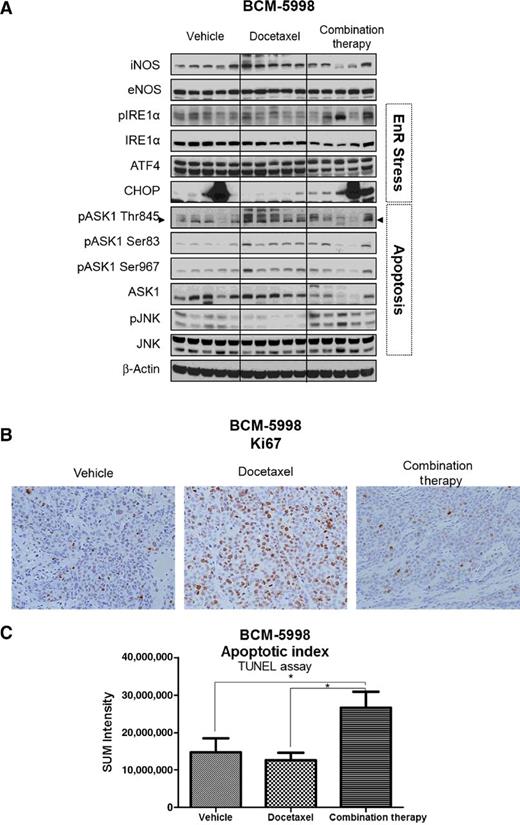 Figure 4. NOS inhibition therapy enhances apoptotic response. A, Mice growing orthotopic tumors BCM-5998 (n = 5) were randomized and treated with vehicle, docetaxel, or combination therapy (docetaxel + NOS inhibition therapy). After 40 days of treatment, tumors were collected and processed, and target engagement, EnR stress, and apoptosis markers were evaluated by Western blot. B, Tumor slides were stained with Ki67 antibody, and a representative picture was selected to show differences between treatments. Amplification, ×20; counterstain, hematoxylin. C, TUNEL assay was performed on paraffin-embedded tumor slides, 10 different ×20 fields were captured per sample, the sum of the intensity was measured, and the average of each treatment was calculated (*, P < 0.05).