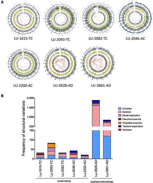 Figure 6. Distribution of somatic structural mutations in lung carcinoid tumors. A, Circos plot showing markedly reduced genomic rearrangements in carcinoids compared with adenocarcinomas. B. Distribution of structural variation types in carcinoid tumors in reference to adenocarcinomas (unpublished).