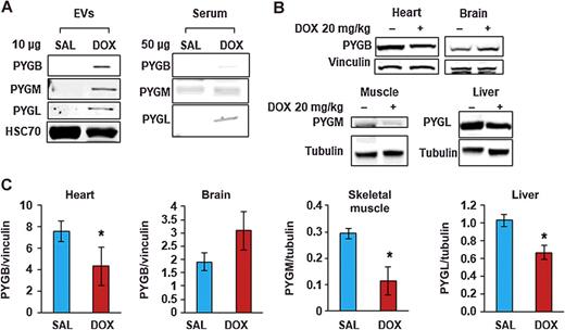 Figure 4. EV-containing glycogen phosphorylase isoforms are associated with DOX-induced tissue injuries. A, Western blot of PYGB, PYGM, PYGL obtained from EVs isolated by sucrose gradient centrifugation and from whole serum protein, HSC70 was used as an EV marker and loading control for EVs. B, Western blot of PYGB, PYGM, and PYGL levels obtained from heart, brain, skeletal muscle, and liver lysates isolated from saline- and DOX-treated mice. Vinculin was used as a loading control for heart and brain tissues; beta tubulin was used as a loading control for skeletal muscle and liver. C, Graphic representation of Western blot band intensities of PYGB, PYGM, and PYGL in the relevant highly enriched tissues and normalized by the appropriate loading control (mean ± SD; n = 6; *, P < 0.05).