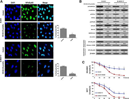 Figure 5. CaMK2α activity is crucial for NFκB nuclear translocation, SERCA2 expression, and cell survival. A, Immunofluorescence visualization of NFκB in the nucleus of CSCs after treatment with KN-62, a CaMK2α inhibitor, during long-term (40 hours) glucose deprivation conditions; scale bar, 12.5 μm. Immunofluorescence staining was performed in triplicate on different days and representative images are displayed. B, Immunoblot analysis of anti-apoptosis– and calcium restoration–related proteins in CSCs after long-term (40 hours) exposure to glucose deprivation. C, Cell viability assay after short- (12 hours) and long-term (40 hours) exposure to glucose deprivation in CSCs treated with KN-62; *, P < 0.05 versus control, **, P < 0.01 versus control.