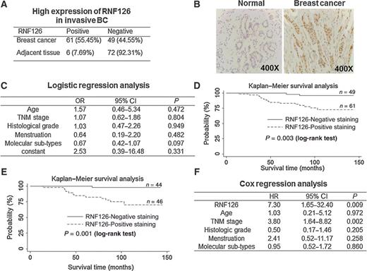 Figure 1. RNF126 high expression was associated with poor outcomes in patients with breast cancer and was an independent predictive marker for a poor prognosis. A, The percentage of invasive breast cancer tumors with RNF126-positive staining was elevated, compared with that of adjacent regions (χ2 test, P < 0.001). B, Representative RNF126 staining detected by IHC in adjacent normal and invasive breast cancer tissues. Anti-RNF126 antibody (ab183102) was used. Adjacent normal tissues were collected 5 cm away from the edge of tumors. Specimens were surgically removed before patients were exposed to any neoadjuvant treatment. C, Logistic regression analysis of RNF126 expression and clinicopathologic parameters. RNF126 expression had no obvious relationship with the indicated clinicopathologic variables. D, Kaplan–Meier survival analysis in patients with invasive breast cancer. Increased RNF126 expression correlates with a lower probability of cumulative survival. Recurrence, metastasis, or death were the final events (n = 110). E, Kaplan–Meier survival analysis in patients with invasive breast cancer who received adjuvant chemotherapy. RNF126-positive staining was also associated with a poor prognosis in patients with a subtype of invasive breast tumor who received chemotherapy (n = 90). F, Expression of RNF126 was an independent predictor of a poor prognosis. Multivariate analyses of RNF126 expression and clinicopathologic parameters in a Cox proportional hazards model are indicated. RNF126-positive staining was an independent factor related to patients' poor outcomes (HR, 95% CI: 95% confidence interval).