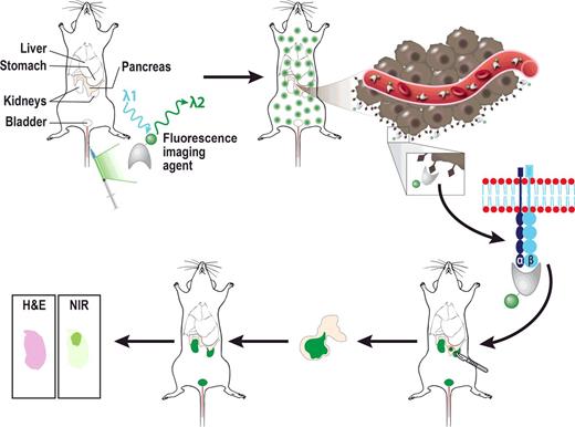 Figure 1. Schematic overview of imaging agent concept. Agent is injected intravenously, and migrates via the vessel to the target of interest (αvβ6). Resection of the pancreatic cancer can be performed guided by fluorescent signal, and fluorescent signal at microscopic level is conformed with tumor status on histopathology. The agent preferably has renal clearance, since fluorescent signal from the liver in case of a hepatic route could interfere with signal from the tumor.