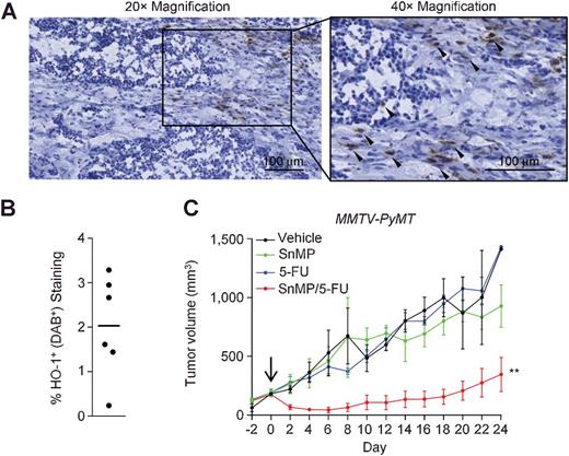 Figure 1. SnMP synergizes with 5-FU to achieve disease remission and control of tumor growth. A, Representative untreated MMTV-PyMT tumor section stained using hematoxylin and antibodies against HO-1 (brown). Arrowheads denote examples of HO-1+ cells. B, Quantification of HO-1+ staining in untreated MMTV-PyMT tumors (average across multiple sections), each dot represents an individual tumor. C, Growth curves of established spontaneous tumors in MMTV-PyMT mice that had received SnMP (25 μmol/kg/day; n = 6) or vehicle (n = 5), with or without 5-FU (40 mg/kg/5 days; n = 6 alone, n = 4 with SnMP). Growth curves are presented as mean ± s.e.m. Tumor growth curves were compared for differences using the “compareGrowthCurves” permutation test (35). **, P < 0.01.