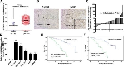 Figure 1. LINC01234 expression is upregulated in gastric cancer tissues and associated with poor prognosis. A, Relative expression of LINC01234 in gastric cancer tissues compared with normal tissue was analyzed using TCGA data. B, In situ hybridization was used to detect LINC01234 expression in gastric cancer tissues and adjacent nontumor tissues. C, LINC01234 expression was analyzed by qRT-PCR in gastric cancer tissues and corresponding adjacent nontumor tissues, and the data were presented as the ΔCt value (n = 50). D, qRT-PCR analysis of LINC01234 expression in the normal gastric epithelium cell line (GES-1) and gastric cancer cells. E and F, Kaplan–Meier OS and disease-free survival curves according to LINC01234 expression levels. Error bars, mean ± SEM. *, P < 0.05; **, P < 0.01.