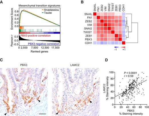 Figure 3. Association of PBX3 and EMT in colon cancer. A, GSEA for genes ranked by Pearson correlation (Pearson r) to PBX3 expression for two core EMT gene signatures by Anastassiou et al. and Taube et al. (29, 30) in gene-expression datasets of n = 856 colon cancers; P < 0.001. B, Heat map indicates clustering and positive correlation of PBX3 expression with colon cancer relevant EMT markers and negative correlation with CDH1. Colors indicate Pearson r from −1 (blue) to 1 (red). C and D, Representative (C) immunohistochemistry and (D) quantification of co-expression for PBX3 and LAMC2 on serial sections of colon cancer. Arrowheads indicate co-staining at the leading tumor edge; scale bar, 100 μm. For quantification n = 300 cells from six colorectal cancers were scored. P and r values are results of linear-regression analysis.