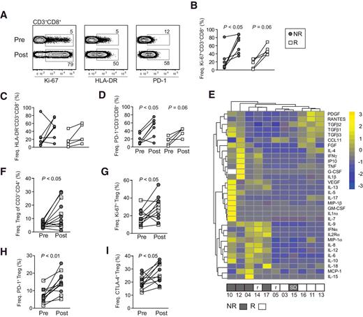 Figure 4. Pronounced recipient T-cell activation and proinflammatory cytokine release in nonresponders following conditioning and infusion of haploidentical NK cells. A, Representative examples of Ki-67, HLA-DR, and PD-1 expression on CD3+CD8+ T cells before (pre) and after (post) (day 28) NK-cell infusion and (B–D) summary of results for all evaluable nonresponders (NR; filled circles, n = 7) and R (open squares, n = 5). E, Heatmap showing nonhierarchical clustering of the cytokine profile at day 28 after NK-cell infusion. Boxes below show clinical response (NR, gray; R, white) and highlight patients who relapsed (r) after achieving objective responses or those with stable disease (SD). Numbers below boxes show patient ID. F, Frequencies of CD3+CD4+CD127−FoxP3+ before and after NK-cell infusion. G–I, Summary of expression of Ki-67, PD-1, and CTLA-4 on CD3+CD4+CD127−FoxP3+ Treg before and after NK-cell infusion (NR; filled circles, n = 6–7) and major responders (R; open squares, n = 5).