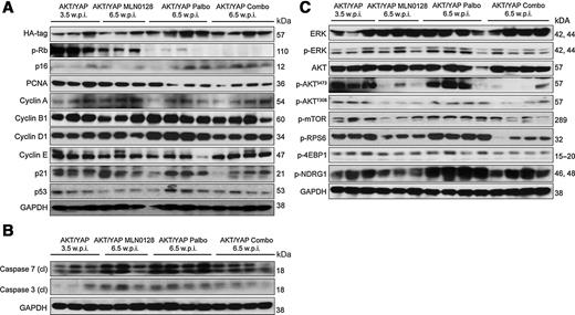 Figure 6. Effect of palbociclib/MLN0128 treatment on the levels of putative target proteins in livers from AKT/YapS127A mice. Western blot analysis was performed to analyze proliferation (A), apoptosis (B), as well as AKT/mTOR and Ras/MAPK (C) pathways in ICC tissues from pretreatment, vehicle-, MLN0128-, palbociclib, and palbociclib/MLN0128-treated AKT/YapS127A mice. Abbreviations: Combo, combined palbociclib/MLN0128 treatment; Palbo, palbociclib; w.p.i., weeks postinjection.