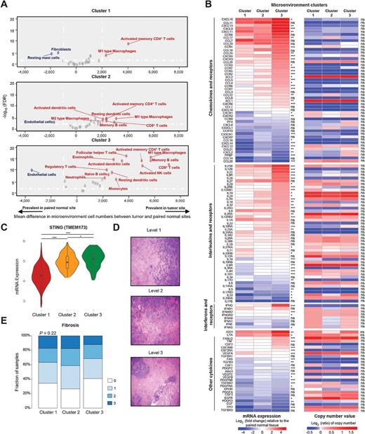 Figure 3. Potential extrinsic immune escape mechanisms of TNBC. A, Volcano plots of enriched (red) and depleted (blue) microenvironment cell subsets compared with the paired normal samples (n = 90) for each cluster. B, Log2-fold change in mRNA expression in the tumor site relative to the paired normal tissue and log2 ratio of copy-number values of chemokines, ILs, IFNs, and other important cytokines and their receptors for each cluster. Molecules with significantly differential expression between the tumor site and the paired normal site (P < 0.01) were illustrated. C, STING mRNA expression among clusters. Typical H & E sections of fibrosis (D) and distributions of fibrosis levels among clusters (E; ***, P < 0.001; **, 0.001 < P < 0.01; *, 0.01 < P < 0.05; ns, P > 0.05).