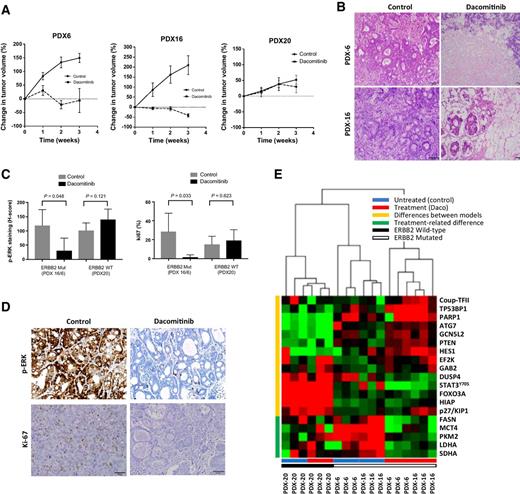 Figure 5. In vivo sensitivity of ERBB2 kinase domain–mutant tumors and wild-type control tumors to ERRB2 inhibition. A, Sensitivity to dacomitinib (Daco) or control (Con) of ERBB2-mutant SBA PDX models PDX6 (derived from SBA-6 cells) and PDX16 (derived from SBA-16 cells) and ERBB2 wild-type (WT) SBA PDX model PDX20. B, H&E-stained representative examples of Daco-treated and control-treated ERBB2-mutant tumors. C, Ki-67 and phospho-ERK from Daco-treated and control-treated PDX models at 3 weeks. D, Representative examples of phospho-ERK and Ki-67 stained Daco-treated and control-treated ERBB2-mutant PDX16 tumors. E, Heatmap representation of normalized median RPPA values for tumors from each of these models at 3 weeks showing cluster classification of significantly (P < 0.05) differentially expressed proteins between WT and ERBB2 mutants, yellow bar, or control versus dacomitinib treatment, green bar.