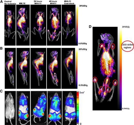 ImmunoPET, [64Cu]Cu-DOTA-Anti-CD33 PET-CT, Imaging of an AML Xenograft ...