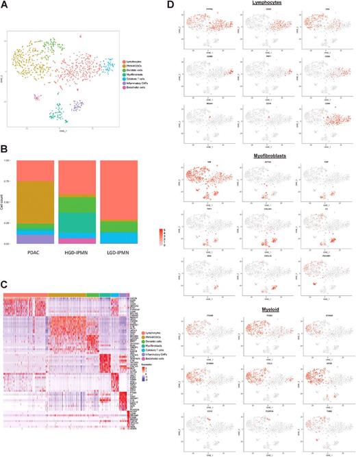 Figure 3. A, tSNE plot of all stromal cells that were virtually microdissection from entire lesions. Different colors represent annotation of unique cell phenotypes. B, Proportion of cell phenotypes enriched in each lesion (PDAC, HG IPMN, and LG IPMN); colors refer to unique cell types in A. C, Heat map of the top 20 differentially expressed genes used to identify cell phenotypes across clusters. D, Feature plots demonstrating expression of specific genes among clusters to identify respective cell types.