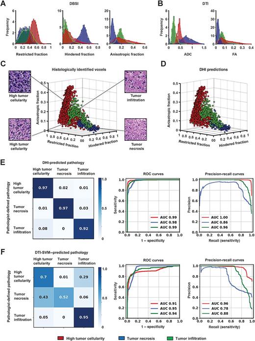 Diffusion Histology Imaging Combining Diffusion Basis Spectrum Imaging ...