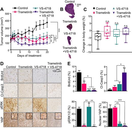 Figure 4. MEKi/FAKi combination uveal melanoma growth in in vivo xenograft mouse models. A, Changes in 92.1 xenograft tumor volume in mice treated with vehicle (control), trametinib 1 mg/kg, VS-4718 50 mg/kg or trametinib + VS-4718. B, H&E staining of representative xenograft tumor sections after 20 days of treatment. C, Difference in mice body weight between day 0 and day 20 of the indicated treatment in 92.1 xenografts mice. Box and whiskers plot with minimum and maximum whiskers (7 mice/group). D, 92.1 tumor-bearing mice were treated with vehicle (control), trametinib 1 mg/kg, VS-4718 50 mg/kg, or trametinib + VS-4718 for 20 days. Representative IHC staining tumor sections for BrdUrd, cleaved caspase-3 (cl-Casp3), pERK, and YAP. Scale bar is 100 μm and insets are 50 μm wide. E, Quantification of the IHC-stained tumor sections. A and E, Data, mean ± SEM (7 mice/group). *, P < 0.05; **, P < 0.01; ***, P < 0.001; n.s., not significant.