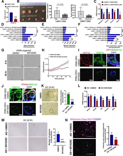 Figure 6. PGC1α-mediated OXPhos and FAO-OXPhos regulate stemness in ADM/PanIN and IPMN, respectively. A, qRT-PCR analysis of Ppargc1a in the scramble and PGC1α KD in LGKC1 cells. The PCR data were normalized with the Actb gene. Data represent mean ± SD (n = 3). B, LGKC1 SCR and PGC1α KD cells were injected subcutaneously into nude mice and maintained with doxycycline (DOX) in water. The subcutaneous tumors were excised 21 days after implantation, followed by the measurement of tumor volume and weight (bar graphs). Data are mean ± SD (n = 4). The significance was determined by a t test (∗, P < 0.05; ∗∗, P < 0.01; ∗∗∗, P < 0.001). C, qRT-PCR analysis of indicated genes in the scramble and PGC1α KD LGKC1+DOX cells. The PCR data were normalized with the Actb gene. Data represent mean ± SD (n = 3). D–F, Basal, maximal respiration, and spare respiratory capacity reflected by OCR due to FAO measured by XF Palmitate-BSA FAO Substrate with the XF Cell Mito Stress Test kit using the Seahorse extracellular flux analyzer. Data are mean ± SEM (n = 3). G and H, Morphology of human IPMN organoids growing in the presence and absence of SR18292. Organoid growth was monitored in the Incucyte Live-Cell Imaging analysis system, which captured images once every 3 hours. Data represent mean ± SEM (n = 3). I and J, Immunofluorescence images of human IPMN organoids stained with PGC1α, PPARγ, CPT1A, and DAPI (as indicated). Scale bar 50 μm. K, 3D Matrigel culture of pancreatic cells isolated from 9-week-old KC mouse pancreas and treated with DMSO or SR18292. The bar graph shows the number of duct-like structures per field. Data represent mean ± SD (n = 6 fields). L, qRT-PCR analysis of indicated genes in DMSO- or SR18292-treated KC pancreatic cells cultured in 3D Matrigel. The PCR data were normalized with the Actb gene. Data represent mean ± SD (n = 3). M, Sphere assay in AD cells sorted from the pancreatic cells of cerulean-treated KC mice. The AD cells were treated with SR18292 at 40 μmol/L for 7 days, followed by sphere count (>50 μm) and imaging analysis. The histogram to the right of sphere images depicts the number of spheres (>50 μm) in indicated samples. Data represent mean ± SD (n = 4). N, Immunofluorescence staining with Mitotracker Deep Red FM and DAPI in SR18292-treated and untreated AD cells sorted from the pancreatic cells of cerulean-treated KC mice. The histogram to the right depicts the arithmetic mean intensity of Mitotracker staining normalized with total DAPI staining. Data represent mean ± SD (n = 8 random images). For all histograms, P values were calculated by Student t test. (∗, P < 0.05; ∗∗, P < 0.01; ∗∗∗, P < 0.001.)