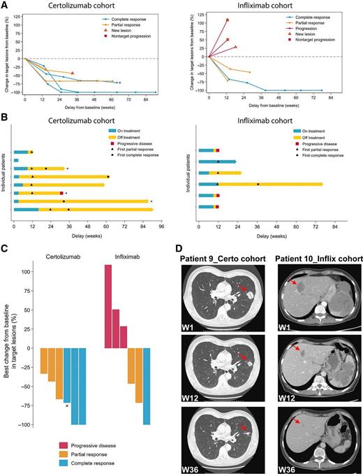 Figure 2. Clear signs of efficacy in patients treated with nivolumab, ipilimumab, and TNF blockers. A, Evolution of tumor burden in patients from the certolizumab (left) and infliximab (right) cohorts over time. One patient in complete response from the certolizumab cohort, who was not evaluable as per RECIST at the first two tumor assessments, is not included in this graph. x: complete response despite two persistent lymph node lesions (<10 mm). B, Evolution of the response in patients from both cohorts over time. +: patients still on nivolumab after discontinuation of study treatment; x: patient evaluable as per RECIST only at the third assessment. C, Best response in all patients. x: patient considered in complete response despite two persistent lymph nodes (<10 mm). D, CT scan images showing examples of target tumor regression in a patient from the certolizumab cohort with a lung metastasis (patient 9, left) as well as in a patient from the infliximab cohort with a liver metastasis (patient 10, right).