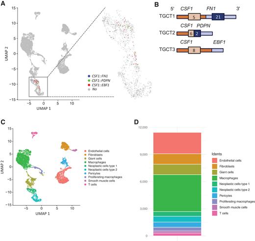 Figure 1. Overview of TGCTs scRNA-seq and long-read mRNA sequencing data. A, UMAP plot with scRNA-seq data from 3 patients with TGCT. The presence of gene fusions involving the CSF1 gene is plotted. The cells harboring fusions are located in two adjacent clusters (box), a blowout of these clusters is shown on the right. B, The three fusions involving CSF1 identified with long-read mRNA sequencing are shown schematically. C, Identified scRNA-seq clusters were named according to their canonical markers, the presence of cells with fusions and s score. D, Bar graph shows the number of cells identified in each of the cell clusters in the scRNA-seq data.