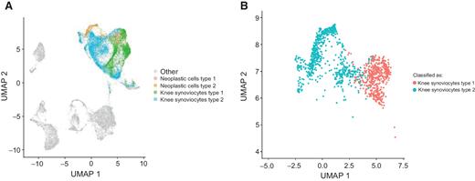 Figure 2. scRNA-seq data from the TGCT cases was compared with published synoviocyte scRNA-seq data from patients with RA (24). The two subtypes of RA synoviocytes correspond to the two clusters of neoplastic cells that were identified in TGCT samples. A, scRNA-seq data from synoviocytes identified in RA was merged with the TGCT scRNA-seq data, showing that the neoplastic cells and synoviocytes cluster close together. B, A SVM classifier was trained on synoviocytes from RA dataset and applied to the neoplastic cells in TGCT. The neoplastic cells type 1 and 2 correspond to the two subtypes of synoviocytes found in RA.