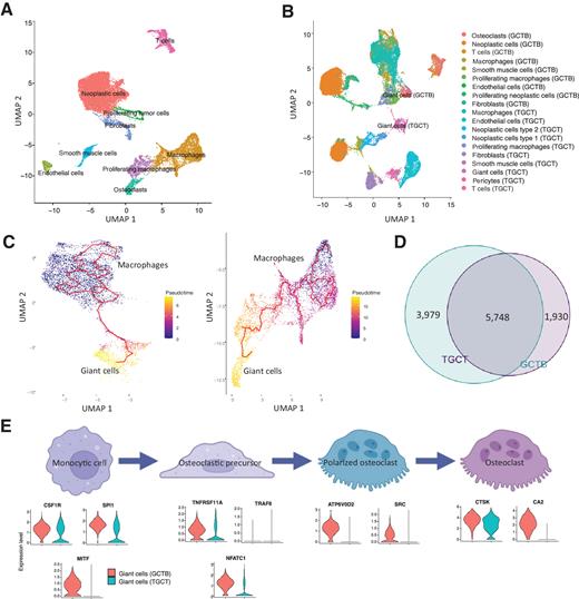 Figure 6. Giant cell development in TGCT is similar to that seen in GCTB. A, UMAP of scRNA-seq data from 2 GCTB specimens. Clusters were named according to canonical markers, the presence of the H3F3A mutation in the neoplastic cells and expression of TP63 and s scores. B, UMAP cluster of merged scRNA-seq data from 2 GCTB and 3 TGCT. The giant cell populations cluster near each other but do not overlap. C, Trajectory analysis from macrophages to giant cells (left, TGCT) and macrophages to giant cells (right, GCTB). D, The development trajectories in TGCT and GCTB show a significant overlap of 5,748 genes (49%). E, RNA expression of canonical markers for different development stages of macrophages to osteoclasts are shown for the giant cell clusters in GCTB and TGCT. Giant cells in GCTB are positive for all reported markers except TRAF6, while giant cells in TGCT are positive for CSF1R, SPI1, TNFRSF11A, and CTSK.
