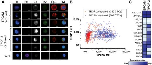 Expression and Therapeutic Targeting of TROP-2 in Treatment-Resistant ...