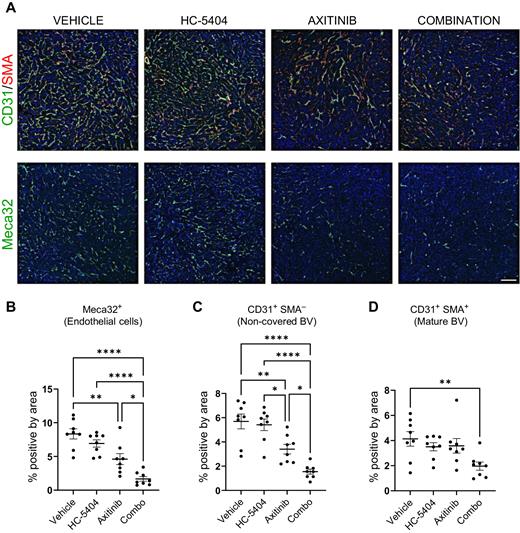 Figure 5. HC-5404 sensitizes 786-O xenografts to the antiangiogenic effects of axitinib. A, IHC images of 786-O xenograft sections stained with antibodies specific to Meca32, CD31, and SMA. Scale bar = 150 μm. HC-5404 and axitinib administered at 30 mg/kg, twice-a-day for 7 days. B–D, Quantification of IHC staining of xenograft sections. Graphs indicate proportion of cells stained positive for Meca32, positive for CD31 in absence of SMA (%CD31+SMA−), or cells that stain positive for both CD31 and SMA (%CD31+SMA+). One-way ANOVA statistical analysis evaluated differences between treatment groups; asterisks indicate significant differences (*, P < 0.05; **, P < 0.01; ****, P < 0.001).