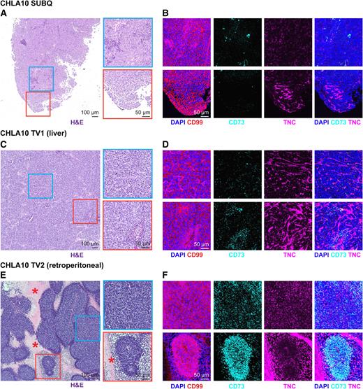 Figure 3. Spatial heterogeneity of CD73+ tumor cells and ECM deposition in vivo. FFPE sections were generated from 3 CHLA10 tumor xenografts from 3 separate mice: one subcutaneous tumor (SUBQ), a liver tumor (TV1), and a retroperitoneal tumor (TV2) formed after tail vein injection. A, H&E staining of the SUBQ xenograft tumor. Right, zoomed insets. B, Immunofluorescence of the same regions in adjacent SUBQ FFPE sections for DAPI (nuclei), CD99 (tumor membrane marker), CD73, and human TNC. C, H&E staining of the TV1 xenograft liver tumor. Right, zoomed insets. D, Immunofluorescence of the same regions in adjacent TV1 FFPE sections for DAPI (nuclei), CD99 (tumor membrane marker), CD73, and human TNC. E, H&E staining of the TV2 xenograft retroperitoneal tumor. Right, zoomed insets. Asterisk marks regional necrosis adjacent to viable tumor borders. F, Immunofluorescence of the same regions in adjacent TV2 FFPE sections for DAPI (nuclei), CD99 (tumor membrane marker), CD73, and human TNC.