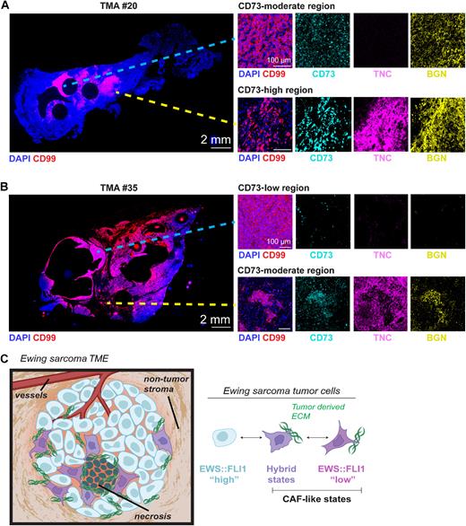 Figure 6. Intra-tumoral heterogeneity of CD73+ tumor cells and ECM deposition in patient biopsies. Immunofluorescence analysis of full tumor biopsy sections: (A) TMA ID #20 (extensive CD73+ scoring on TMA) and (B) TMA ID #35 (negative CD73 scoring on TMA). DAPI (nuclei), CD99 (tumor membrane marker), CD73, Tenascin-C, and biglycan. Right panels, zoomed insets show regions from the same tumor section with disparate CD73 expression and ECM deposition. C, Model of cell state heterogeneity in EwS wherein tumor contains spatially and transcriptionally heterogeneous subpopulations of tumor cells. Selective derepression of EWS::FLI1-suppressed mesenchymal target genes leads to acquisition of mesenchymal identity without loss of EWS::FLI1-dependent gene activation and tumorigenicity. These transcriptionally hybrid cells display properties of CAFs and promote remodeling of the TME by depositing pro-tumorigenic ECM. (C, Created with BioRender.com.)
