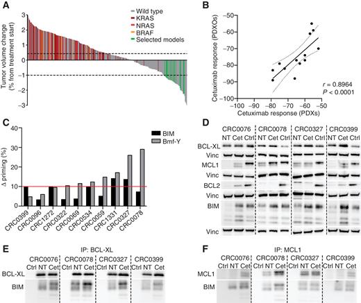 Figure 1. EGFR blockade increases apoptotic priming and induces preferential binding of upregulated BIM to BCL-XL. A, Cetuximab response after 3 weeks of treatment (20 mg/kg, intraperitoneal injection twice a week) compared with tumor volume the day before treatment initiation in 314 mCRC PDX models (n = 6 or 12 mice for each bar, depending on whether initial engraftment was successful in 1 or 2 mice). Response categories were arbitrarily defined: regression (below the lower dotted line, −50%); progressive disease (above the upper dotted line, +35%); and disease stabilization (between the dotted lines). Wild-type denotes cases with no mutations in KRAS, NRAS, or BRAF. Selected models denotes cases from which PDXOs were generated. B, Scatter plot showing simple linear regression of cetuximab response profiles in 13 selected PDXOs (percentage of cell viability reduction relative to untreated controls) and in their corresponding PDXs of origin (percentage of tumor volume variation after 3 weeks of treatment compared with tumor volume the day before treatment initiation). Organoids were treated with cetuximab (20 μg/mL) for 1 week, then cell viability was assessed by ATP content (Cell Titer Glo assay). PDXs were treated with cetuximab as described in A. Dotted lines indicate the 95% confidence bands of the best-fit line. Statistical analysis by Spearman correlation coefficient. C, Delta priming response to BIM (0.003 μmol/L) and Bmf-Y (1 μmol/L) peptides in 10 PDXOs after cetuximab treatment (24 hours, 20 μg/mL). Delta priming = % cytocrome c losscetuximab − % cytocrome c lossuntreated. Each bar represents the average of two independent experiments or, for CRC0078, a single experiment. Western blot analysis with the indicated antibodies in whole-cell extracts (D) or after immunoprecipitation with antibodies agains BCL-XL (E) or MCL1 (F) in four PDXOs. Organoids were treated with 20 μg/mL cetuximab for 72 hours. NT, untreated control; Cet, cetuximab; Vinc, vinculin (loading control); Ctrl, BT-474 cell extracts as a positive control for antibody specificity (D) or beads without capture antibody as a negative control for immunoprecipitates (E and F). Images from a second experiment on independent biological replicates are shown in Supplementary Fig. S1.
